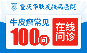 重庆治疗银屑病哪里好